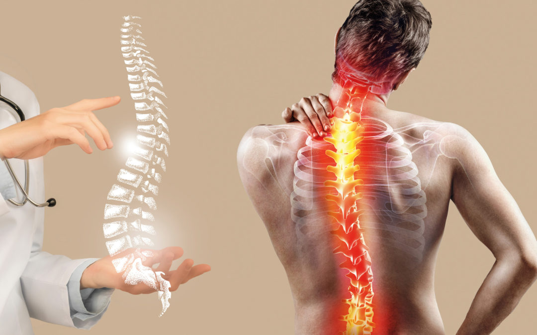 Problemas de dolor de espalda: quiropráctico cerca de mí