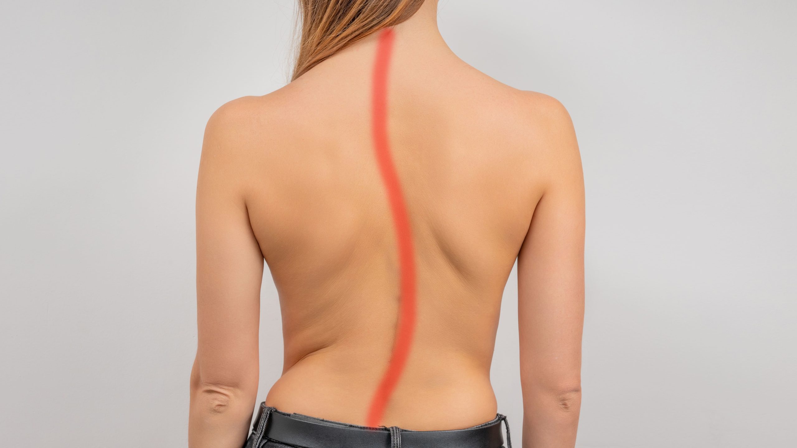 Chiropractic treatment for scoliosis